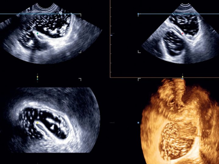 Echographie Gynecologie GHEF Formation Medecin EPU